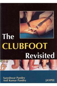 Club Foot Revisited