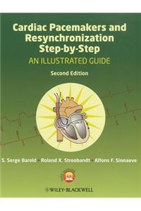 Cardiac Pacemakers and Resynchronization Step by Step