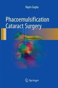 Phacoemulsification Cataract Surgery