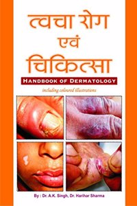 TWACHA ROG & CHIKITSA (HANDBOOK OF DERMATOLOGY)