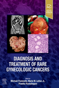 Diagnosis and Treatment of Rare Gynecologic Cancers