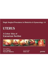 Single Surgical Procedures in Obstetrics and Gynaecology - Volume 14 - Uterus