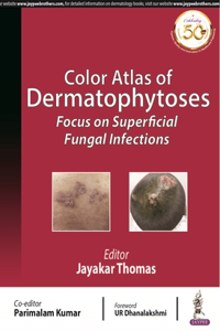 Color Atlas of Dermatophytoses