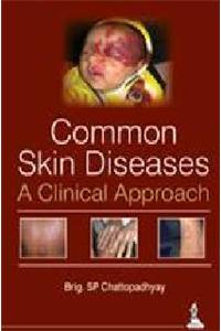 Common Skin Diseases