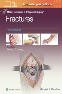 Master Techniques in Orthopaedic Surgery: Fractures