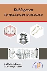Self-Ligation - The Magic Bracket In Orthodontics