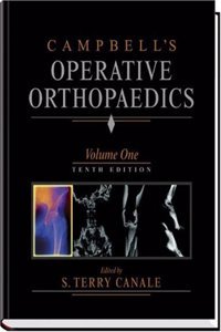 Campbell's Operative Orthopaedics: 4-Volume Set with CD-ROM Hardcover â€“ 12 November 2002