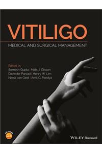 Vitiligo