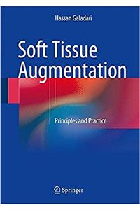 Soft Tissue Augmentation