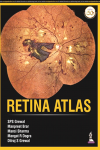 Retina Atlas