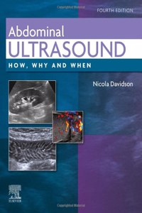 Abdominal Ultrasound