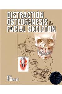 Distraction Osteogenesis of the Facial Skeleton