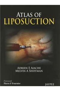 Atlas of Liposuction