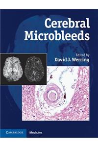Cerebral Microbleeds