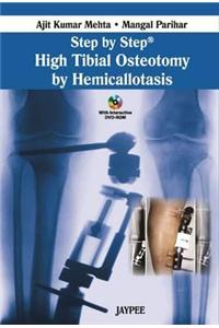 Step by Step: High Tibial Osteotomy by Hemicallotasis