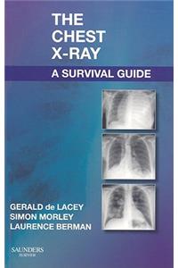 Chest X-Ray: A Survival Guide