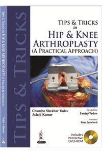 Tips and Tricks in Hip and Knee Arthroplasty