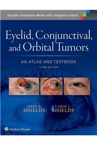 Eyelid, Conjunctival, and Orbital Tumors: An Atlas and Textbook