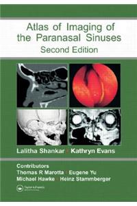 Atlas of Imaging of the Paranasal Sinuses, Second Edition