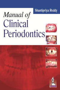 Manual of Clinical Periodontics