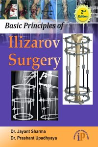 Basic Principles of Ilizarov Surgery (2e) - Second Edition