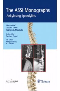 The ASSI Monographs: Ankylosing Spondylitis