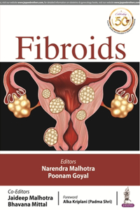 FIBROIDS