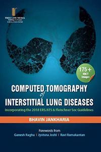 Computed Tomography of Interstitial Lung Diseases