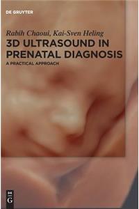 3D Ultrasound in Prenatal Diagnosis