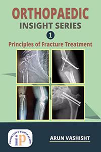 Orthopaedic Insight Series 1 : Principles of Fracture Treatment
