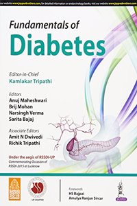 Fundamental Of Diabetes