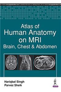 Atlas of Human Anatomy on MRI