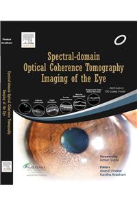 Spectral Domain Optical Coherence Tomography Imaging of the Eye