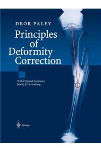 Principles of Deformity Correction