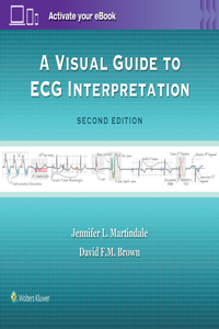 Visual Guide to ECG Interpretation