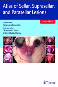 Atlas of Sellar, Suprasellar, and Parasellar Lesions