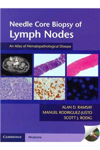 Needle Core Biopsy of Lymph Nodes with DVD-ROM