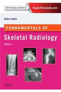 Fundamentals of Skeletal Radiology