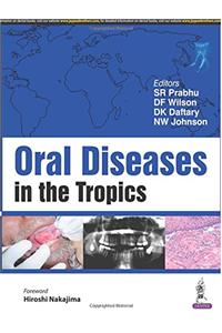 Oral Diseases in the Tropics