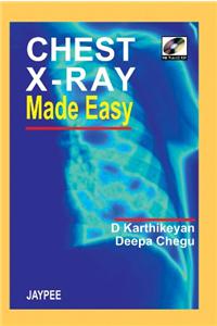 Chest X-Ray Made Easy with Photo CD-ROM