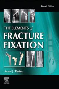 The elements of fracture fixation, 4e