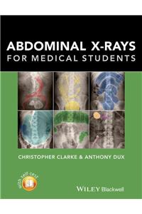 Abdominal X-Rays for Medical Students