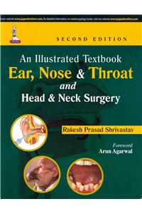 An Illustrated Textbook: Ear, Nose & Throat and Head & Neck Surgery
