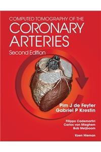 Computed Tomography of the Coronary Arteries