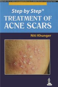 Step by Step: Treatment of Acne Scars