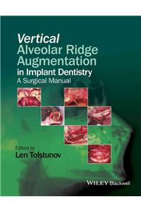 Vertical Alveolar Ridge Augmentation in Implant Dentistry