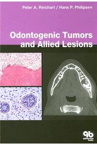 Odontogenic Tumors and Allied Lesions