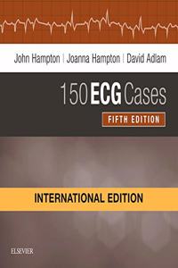 150 ECG Cases, International Edition