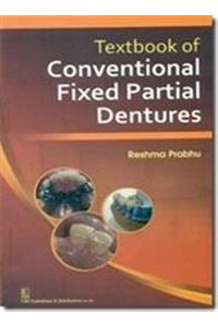 Textbook of Conventional Fixed Partial Dentures