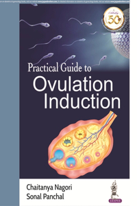 Practical Guide to Ovulation Induction